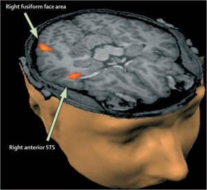 PIIS0140673609613763.gr2.lrg